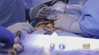 Johns Hopkins Neurosurgeons Perform First Augmented Reality Surgery