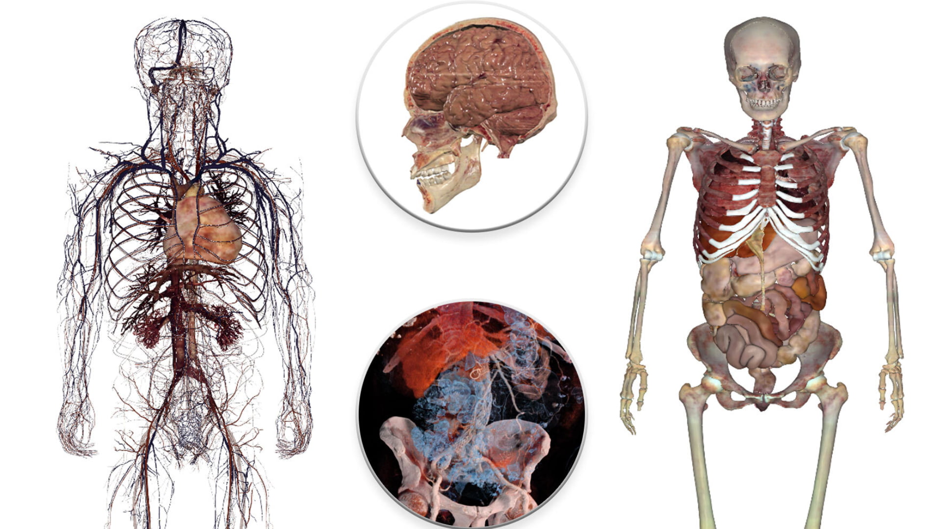 Virtual Reality ermöglicht völlig neue Blickwinkel. Mit einer Anatomie-Lern-App könnt ihr nun durch einen echten menschlichen Körper reisen.